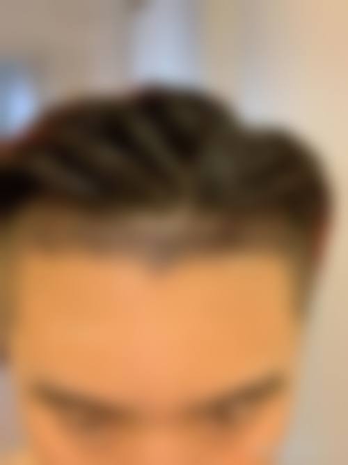 杨凡医生技术优势