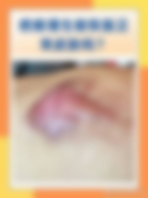 五、选择西安大麦微针植发有哪些优势？