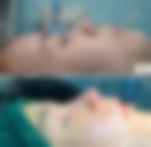 济宁名媛医疗美容门诊部真实实例