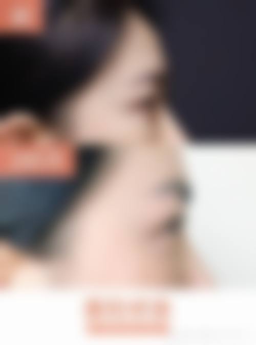 显微镜精修的史迎军眼修复技术