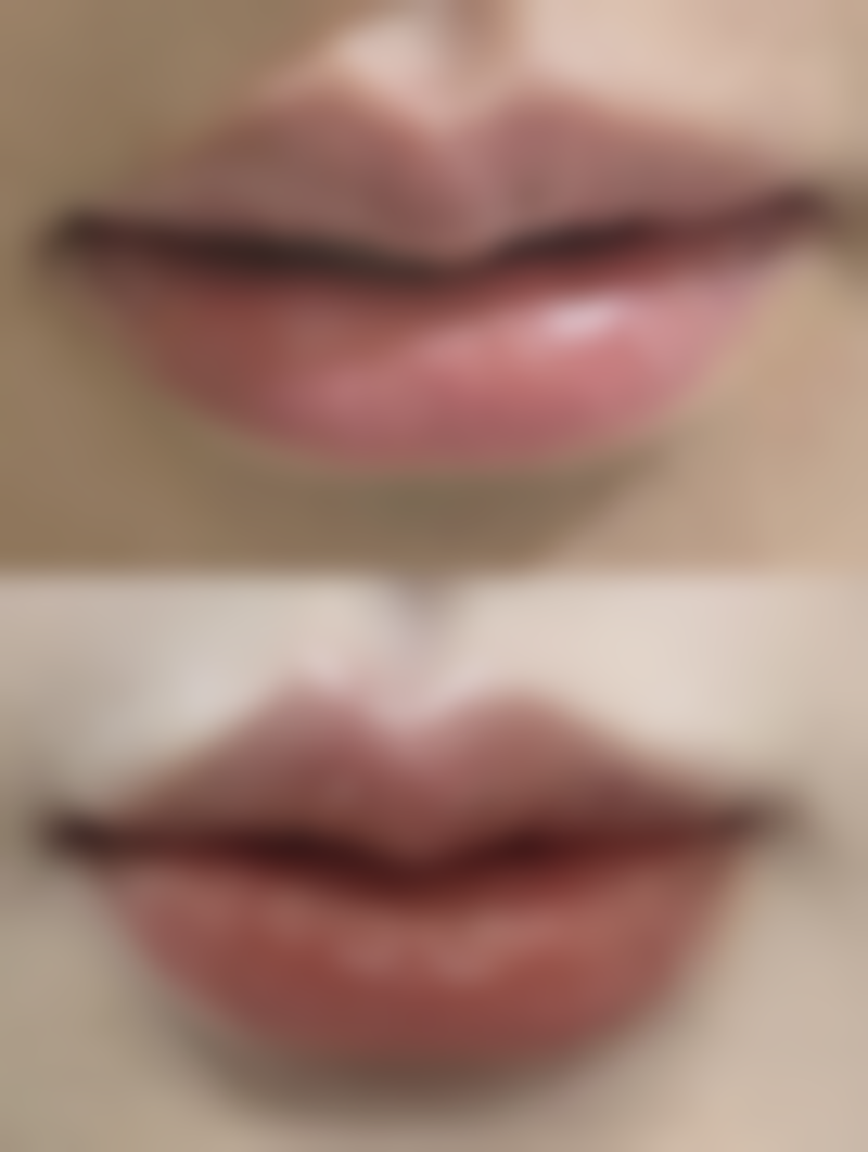 王雅菊医生预约挂号