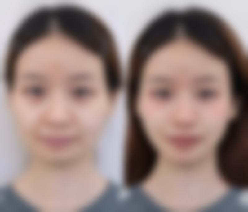 应城市中医医院预约挂号指南