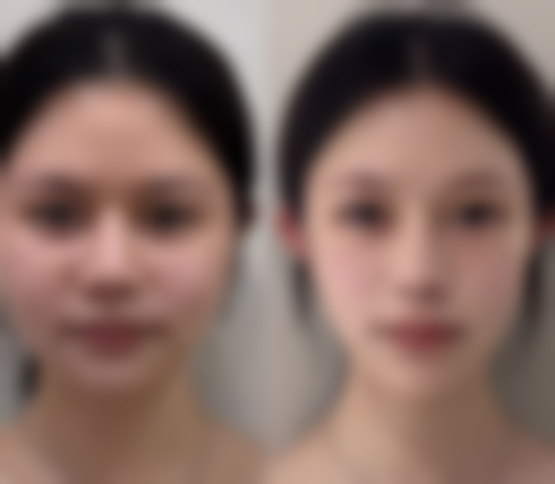 王雅菊医生口碑评价及真人实例