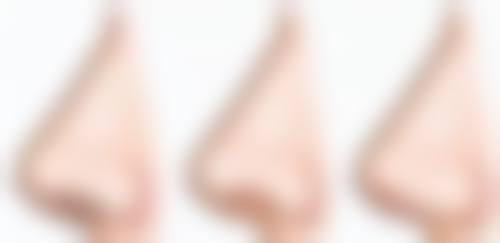 李长富隆鼻术后复查预约提醒