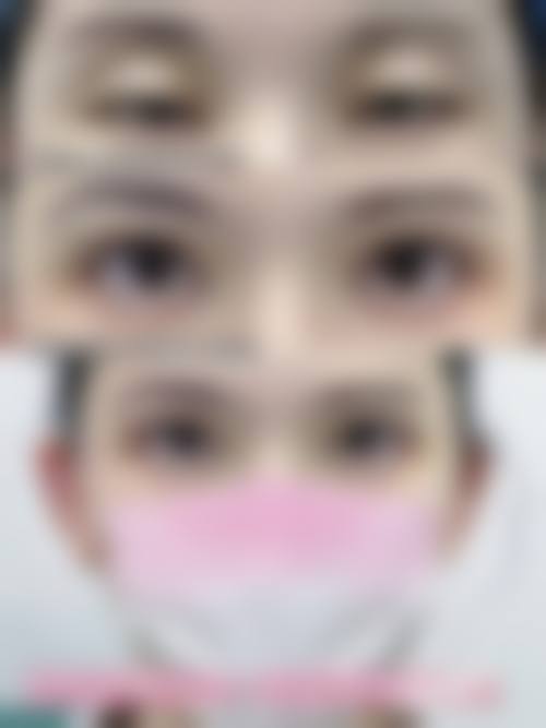 赖东兰医生技术优势