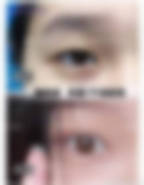 详细的预约挂号方式及流程