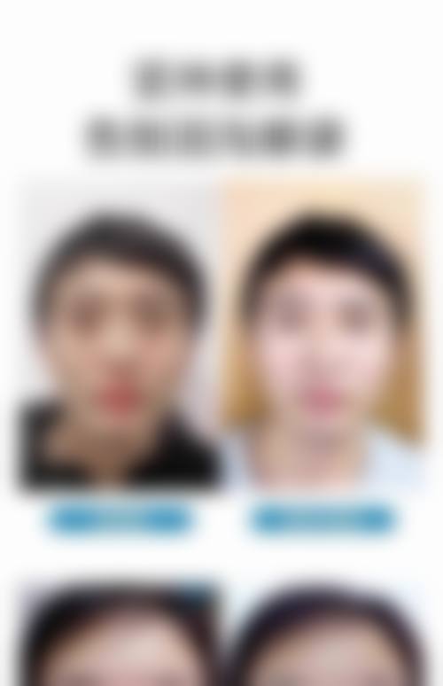 二、各医院微创去眼袋的技术特色