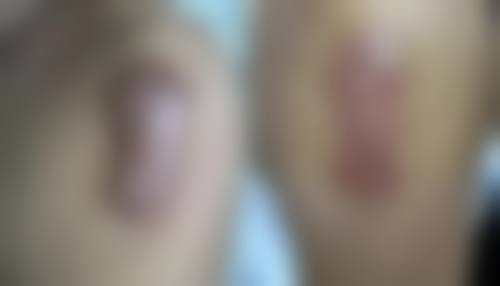 淮北祛疤比较好的医院有哪些？：公立三甲领衔，激光祛疤+医保可报