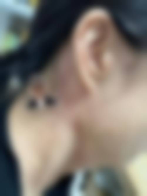 五、儿童祛疤医院推荐