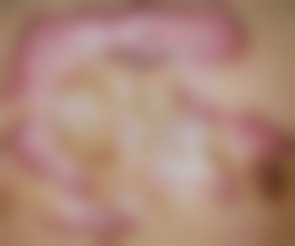 二、国有三等甲医院祛疤优势