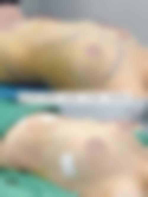 苏曼医生擅长项目