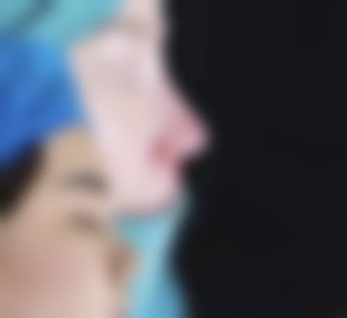 安新县美龄整形医院详细的预约挂号方式及流程