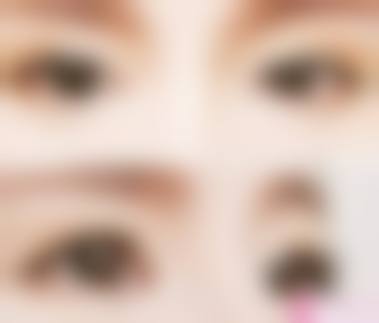 李鹰医生口碑评价及真人实例