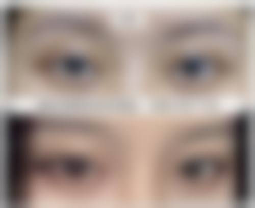 曹晗医生擅长项目