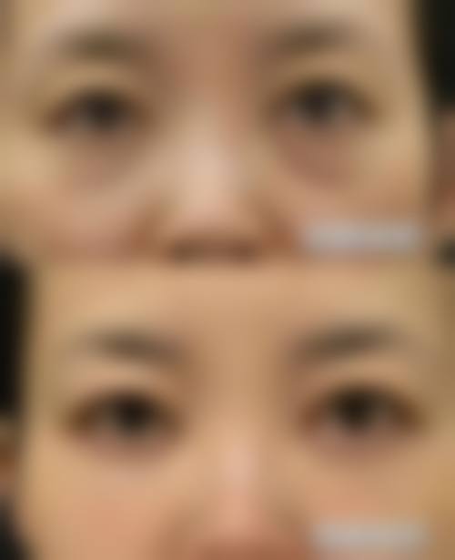 七、河南省郑州人民医院整形外科收费价格表/收费标准