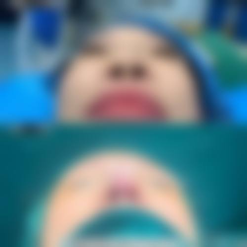 萍乡艾莱芙医疗美容医院价格表