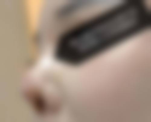 祝顺武医生技术优势