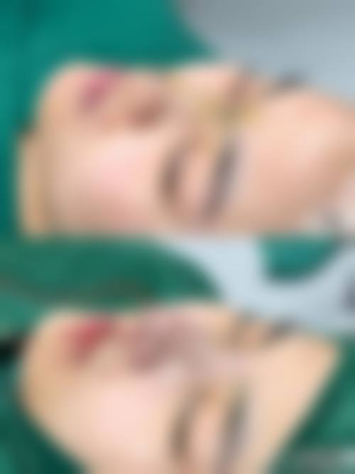 芜湖伊莱美整形美容医院口碑评价