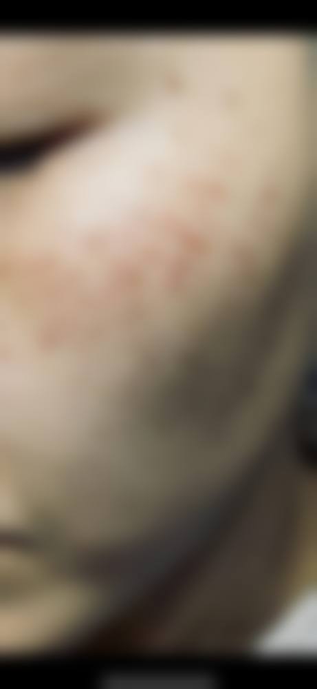 九、患者常见问题解答（精选）