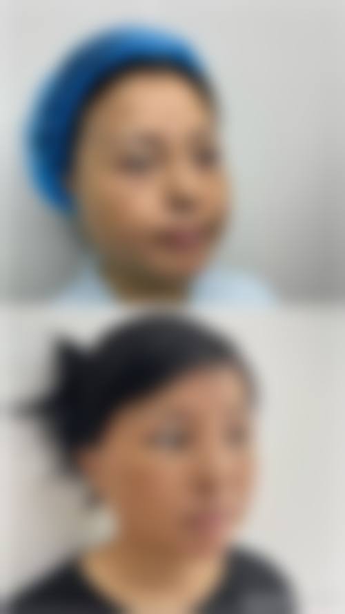 重庆正规整形医院排名前十：含华美、松山医院，潘宝华、肖林坐诊，磨骨技术硬核，洗纹身2000元起