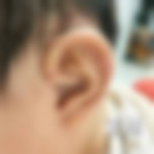 二、河南省郑州人民医院整形外科正规吗？