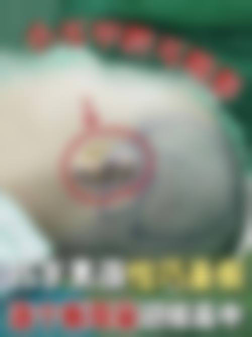 八、河南省郑州人民医院整形外科真人口碑评价怎么样？