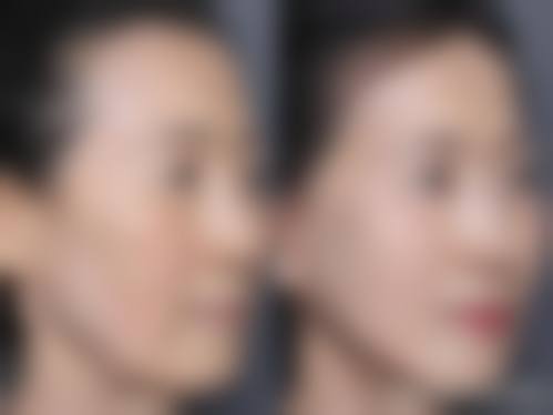 七、哈尔滨伊美瑞尔医疗美容门诊部真人口碑评价怎么样？