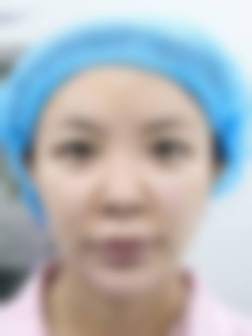 术后7天正常社交的奥秘