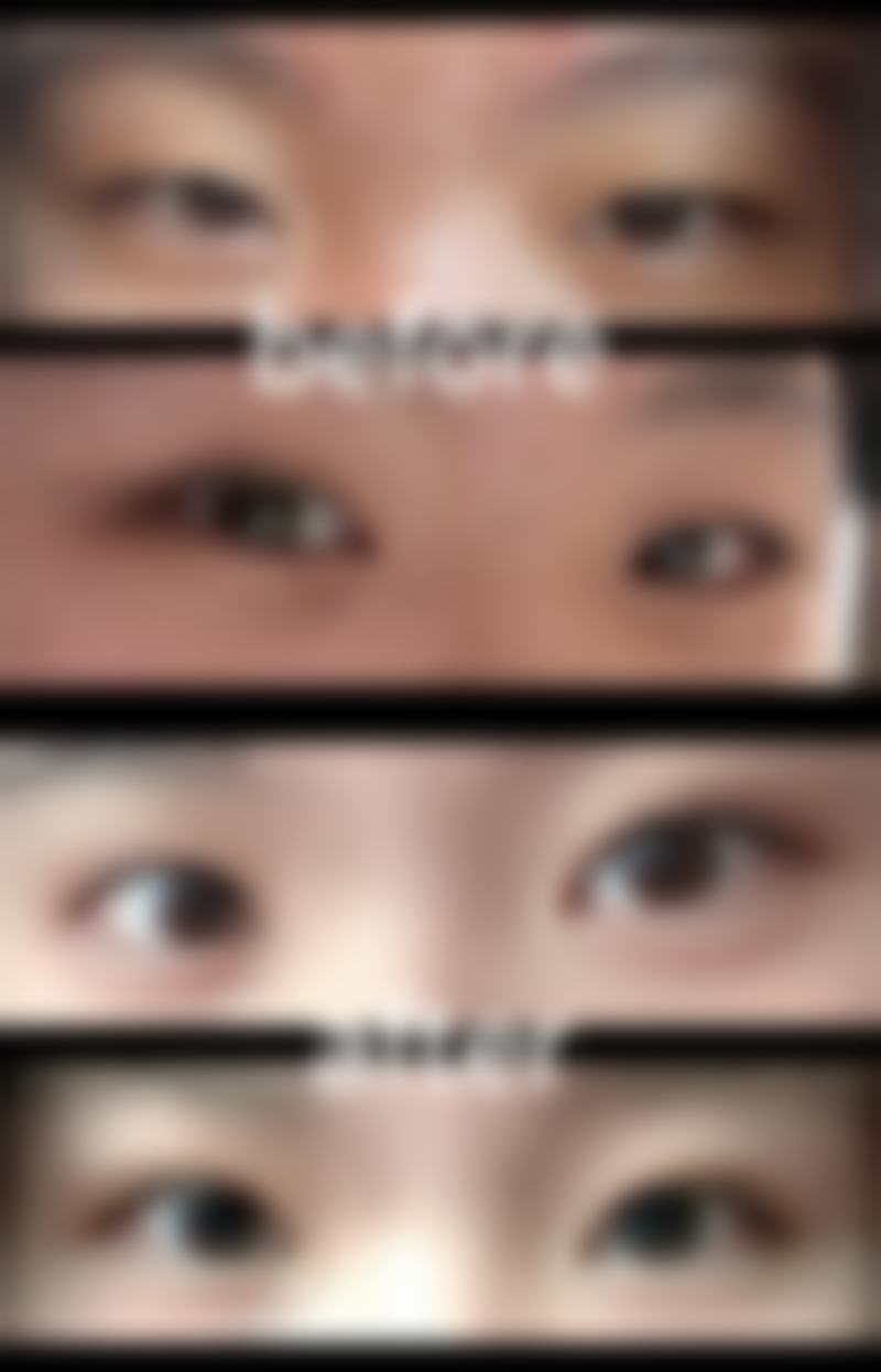 聂子珍医生擅长项目