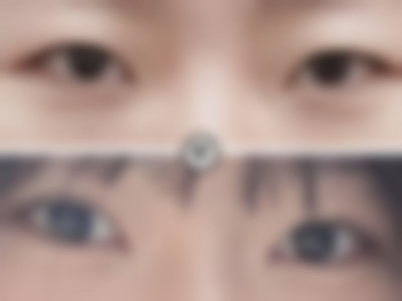 苏曼医生口碑评价及真人实例