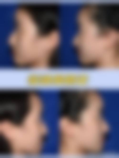 孟爱琴医生技术优势