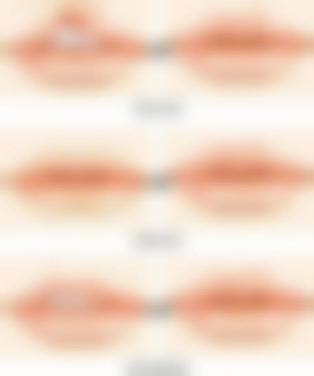 唐山悦韩医疗美容诊所特色项目及技术优势