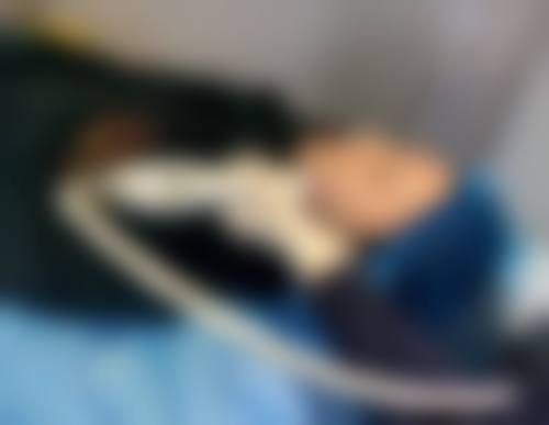 杜太超医生小拉皮的微创隐痕优势