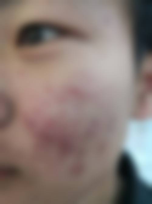 七、什邡市尚美医疗美容诊所真人口碑评价怎么样?