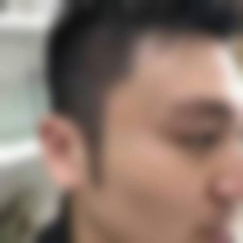 二、苏州新生植发正规吗?