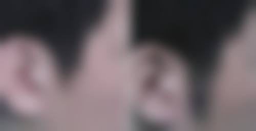 七、苏州新生植发收费价格表/收费标准