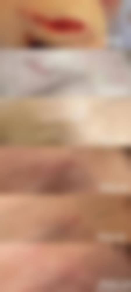 三、西 京医院整形科全切双眼皮项目怎么样