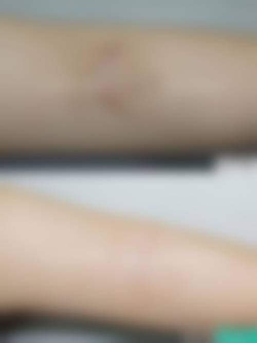 四、西 京医院整形科其他热门美容项目及价格