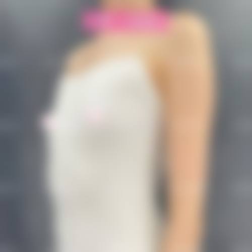 惠州芝华整形医院价格表 / 收费区间参考