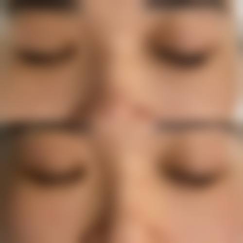 潍坊市中医院(美容科)诊疗项目有哪些