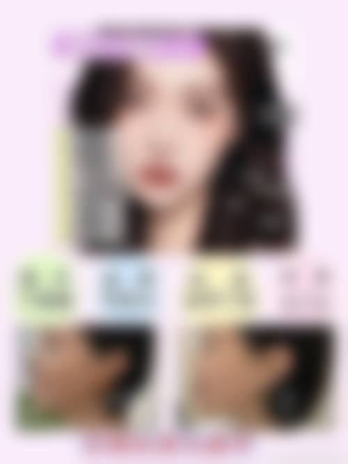 二、海峡医疗美容的面部除皱优势