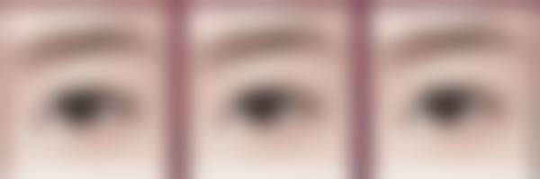 台州艾丝贝医疗美容门诊部真人口碑评价怎么样？