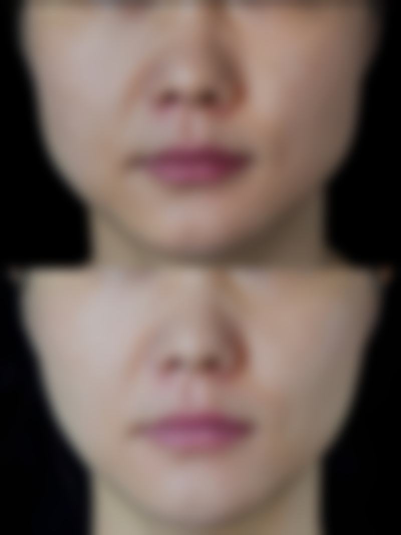 杜太超医生小拉皮的技术与口碑保护