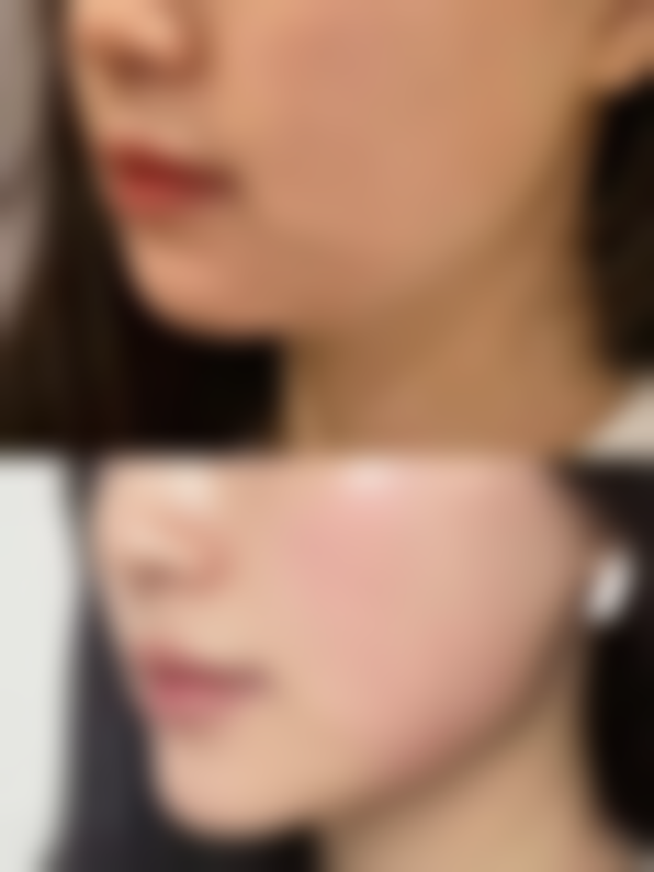 洗纹身去医院还是纹身店好