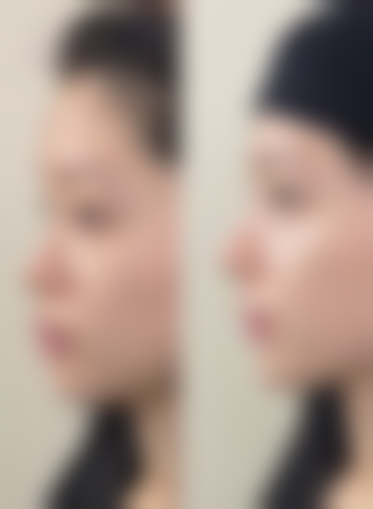 广州广美美姿整形医院常见问题解答