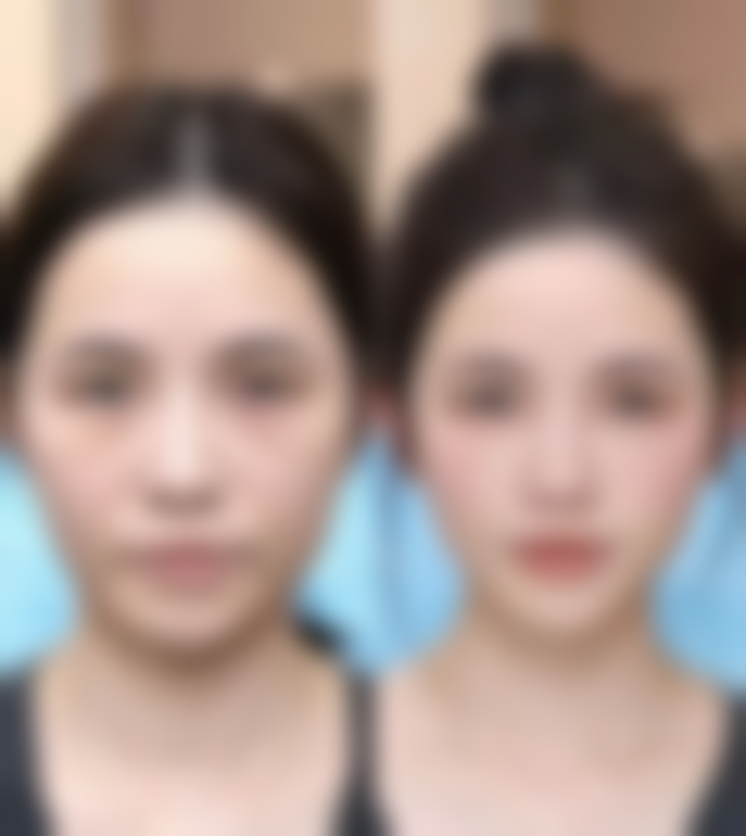 潍坊市中医院(美容科)激光治疗技术怎么样