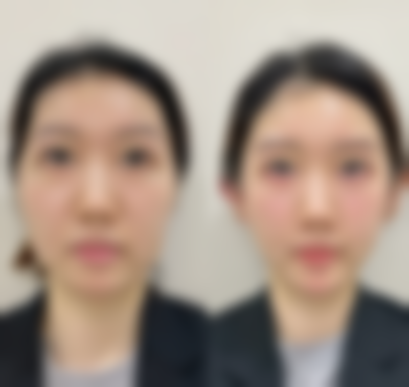 广州广美美姿整形医院地址电话及到院路线