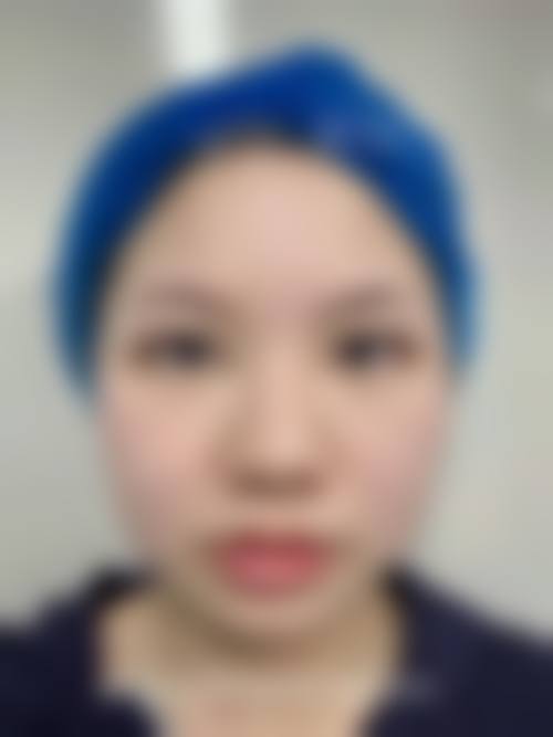 赖东兰医生擅长项目