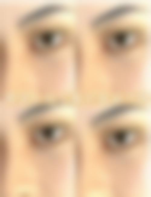 胡寅医生擅长项目