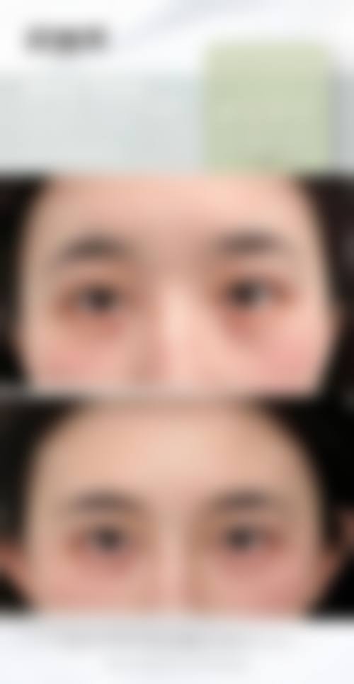 赖东兰医生技术优势